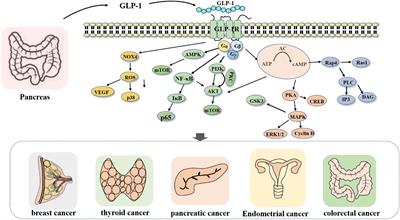 Glucagon-like peptide-1 receptor agonists in neoplastic diseases